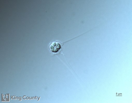 Photo of Apedinella spinifera